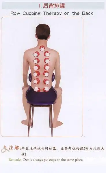 现在拔罐可以拔脊椎吗