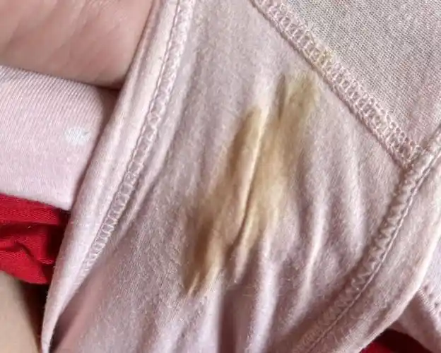 内裤脏脏的.正常吗