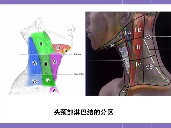 颈部淋巴结分区及转移的影像特征ppt