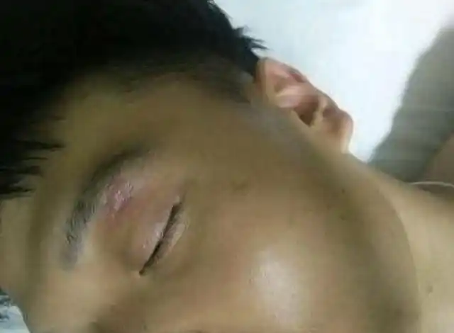 受到损坏时,铁物质会从肝脏流到血管当中,从而造成脸色发青等的症状