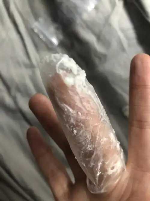 是豆腐渣状白带吗有图慎入