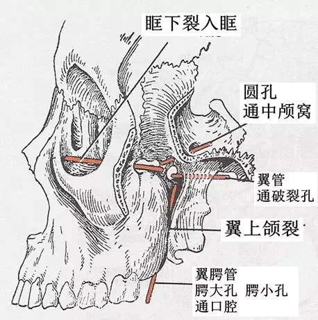 收藏) 写美篇前壁:上颌窦的后壁 后壁:蝶骨大翼前面的下部和翼突根部