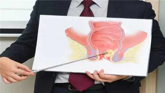 女性肛门痔疮检查项目有哪些