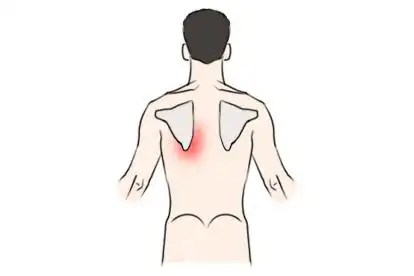 左肩胛下区疼痛示意图_妙手医生