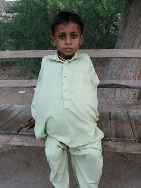 9岁小男孩骨瘦如柴肚子却大如篮球感觉快要爆炸了