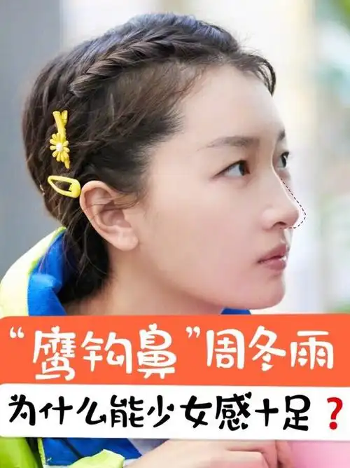 虽然大多数有鹰钩鼻的女生,都是成熟感强的御姐风,但_圈子-新氧美容