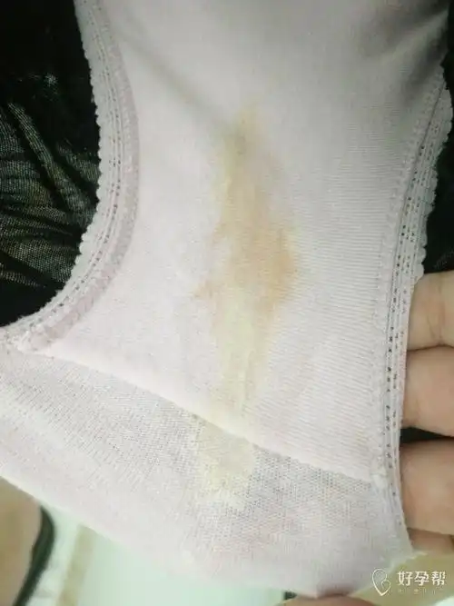 医生帮忙看看这是不是血