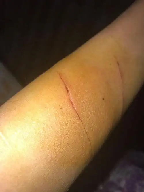 刀划伤自己的图片,手臂被小刀划伤图片-图片大观-奇异网