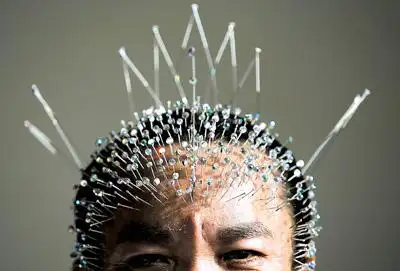 广西男子头上扎800根针 称为了宣扬针灸术(图)