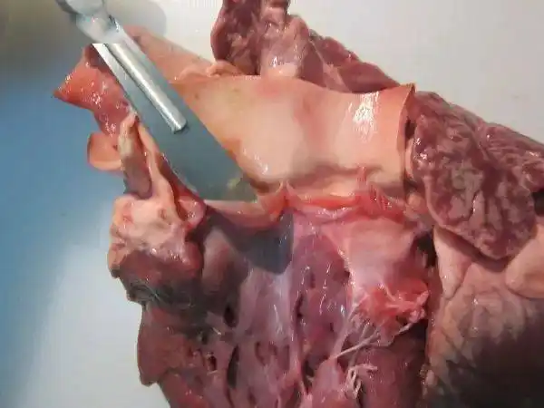 身为一名法医,我来实际解剖一颗心脏_冠状动脉