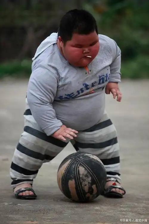 儿童肥胖问题原因与应对策略