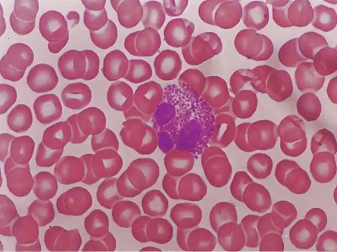 中性粒细胞高说明什么(血常规检查中) - 百百科