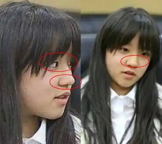 宋雨琦出道前照片流出,看清她怼脸拍后:医生号码麻烦给我一下?