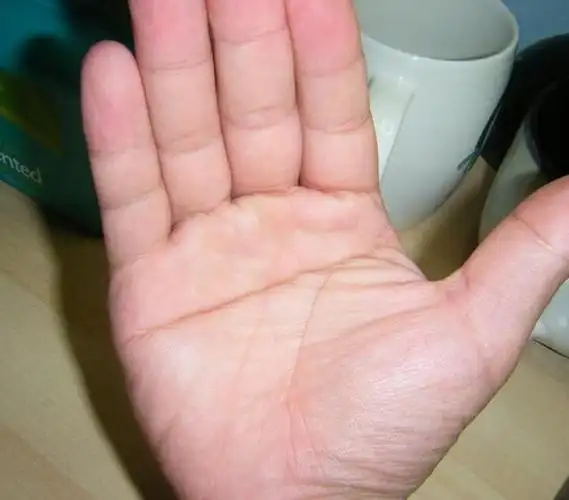 男人手掌纹路断掌(男人手掌纹路断掌怎么回事)