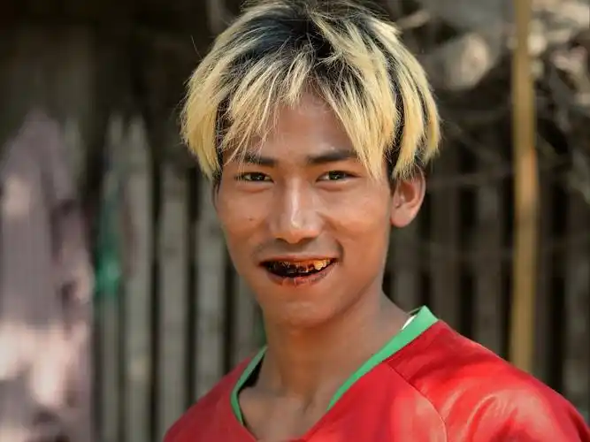 缅甸男人为什么满嘴流血