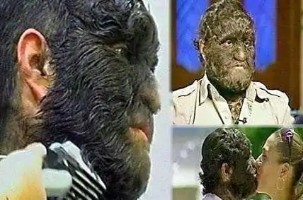 那些真实存在的"变异人"