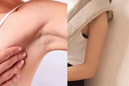 腋窝下长淋巴结别恐慌 了解原因及时处理很重要