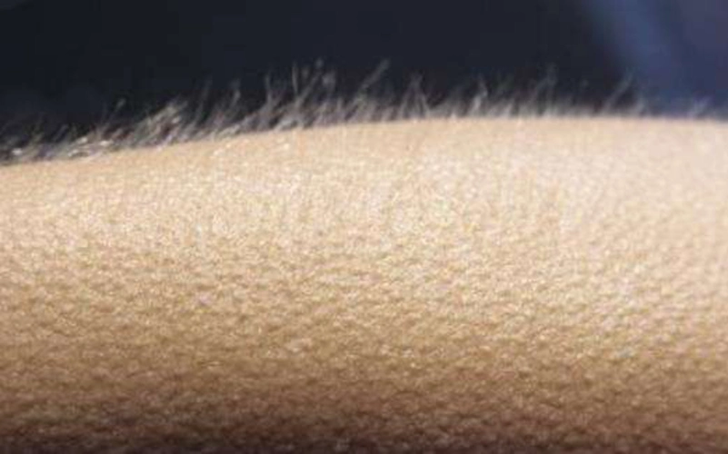 人为什么起鸡皮疙瘩?|鸡皮疙瘩|皮肤|刺激|-健康界