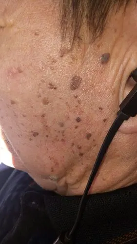 老人脸上长的什么呀?