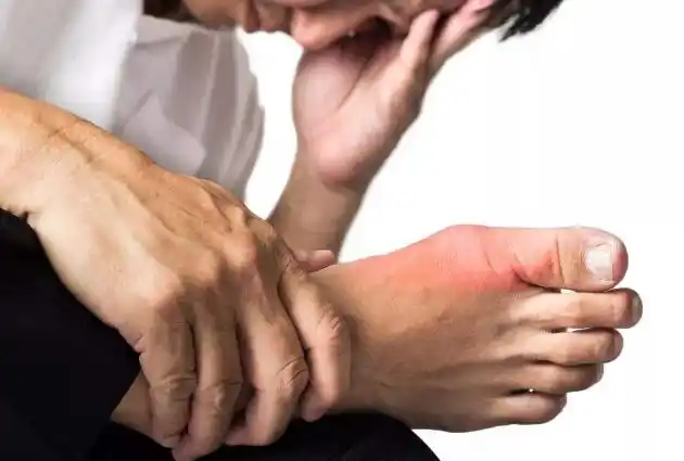 近年来除了中年男人和绝经妇女发病率偏高外,年轻人也成了痛风高发的