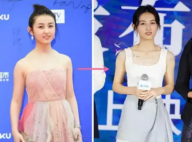 脂肪医生韩炜怎么看待直角肩与溜肩之争