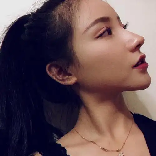 现在的鼻子效果就是我想要的"高挺直鼻"!