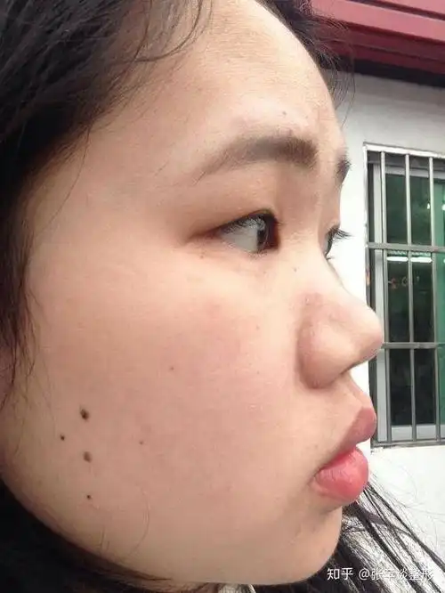 鼻梁的高低带给你颜值的差距有多大 - 知乎