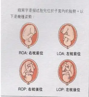 2,代表骨名称,如顶先露为"枕",即"o",臀先露为"骶",即"s",面先露为"颏
