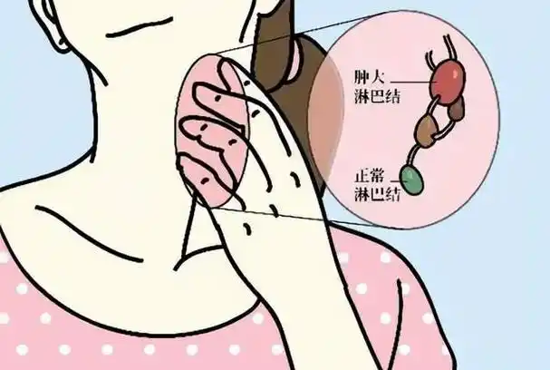 01,炎症包括急性淋巴结炎和慢性淋巴结炎.