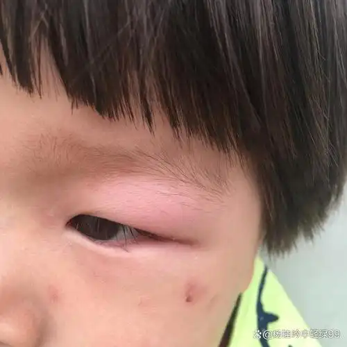 九成人不知蚊子天敌是啥教你个土招只需5分钟让蚊子跑了