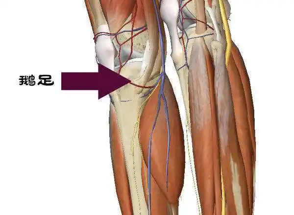 膝痛可能是鹅足肌腱炎
