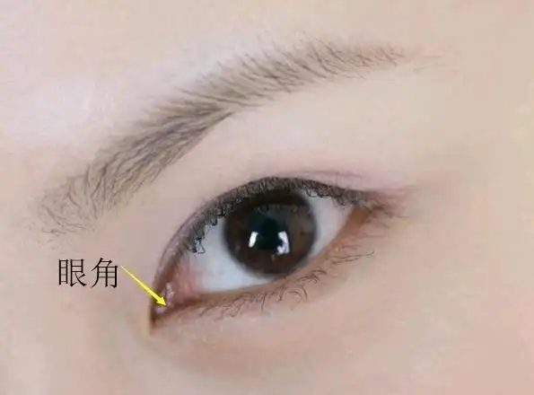 切开双眼皮要配合开眼角吗?