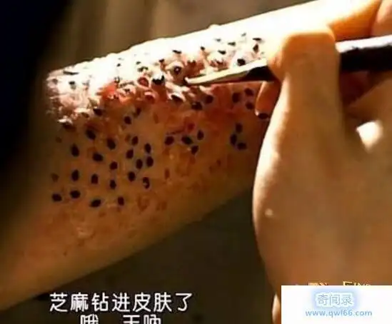 毛孔芝麻女孩恐怖图片曝光女孩毛孔粗大芝麻洗澡恶心至极