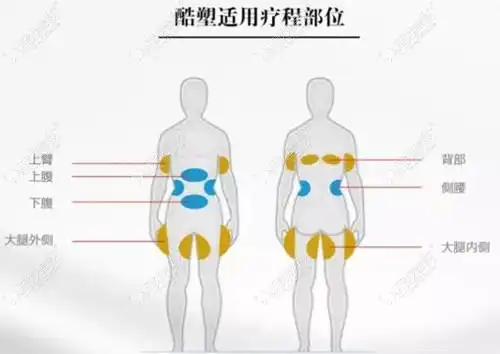 问瘦大腿做酷塑要做几个点想做冷冻溶脂16个点会瘦多少呢
