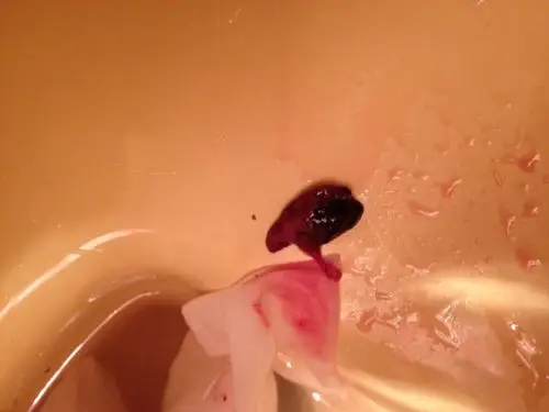 我5号药流,最近两天血就少了,几乎没有了,刚才洗澡出