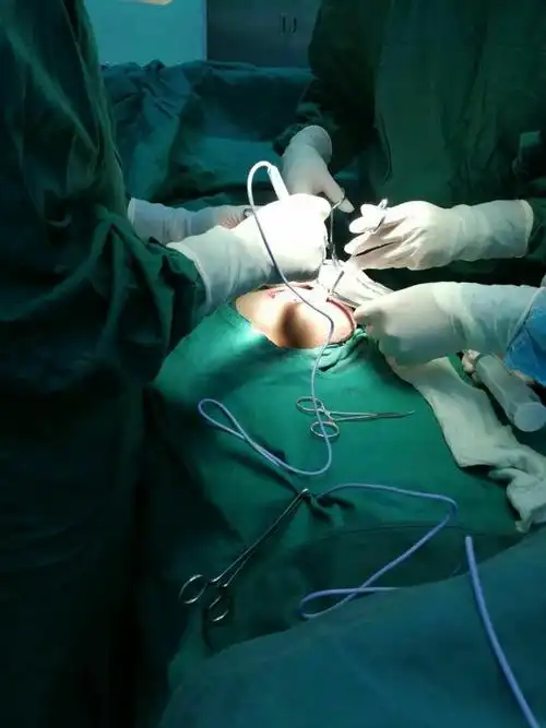 睾丸肿瘤切除术