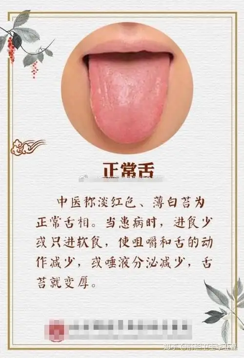 你的舌头还好吗?快来测一测你属于哪种舌苔? - 知乎