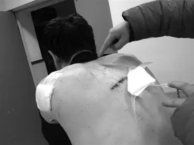 北京站候车室内,流动商贩李民(化名)被一女子持刀扎伤背后及手臂,行凶