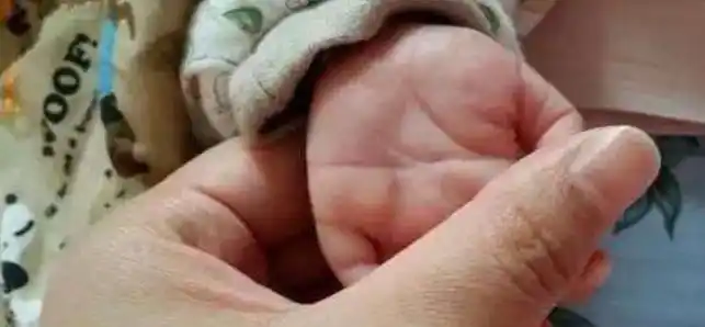 孩子出生双手断掌,婆婆觉得会大富大贵,结果听到医生的话傻了