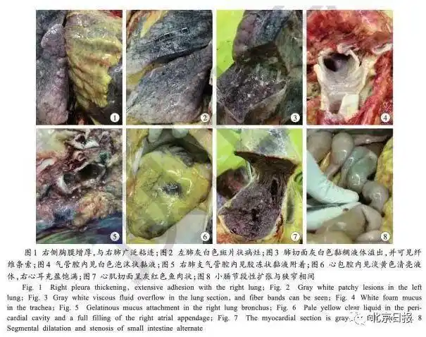首例新冠肺炎逝者尸检结果公布
