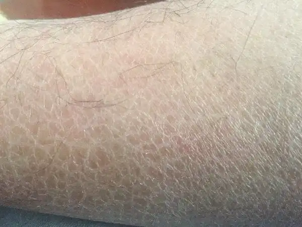 皮肤为什么会这样啊,天天洗澡这应该不是脏的吧