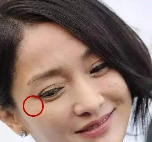 这10位明星脸上都有疤,郑爽被怀疑整容,杨幂自拍只爱拍半边脸!