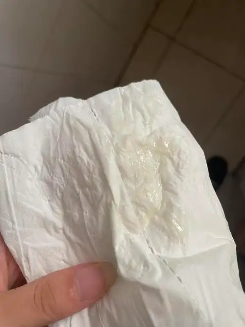 白带常规一直白细胞高,白带黄且多,查不出病原咋办阿