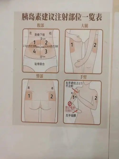 最近血糖指标和胰岛素针及可打的位置