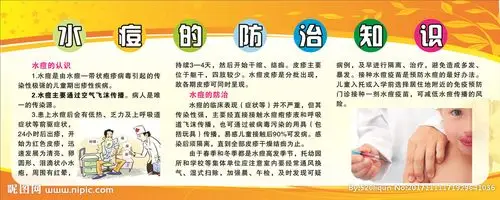 水痘的防治知识图片