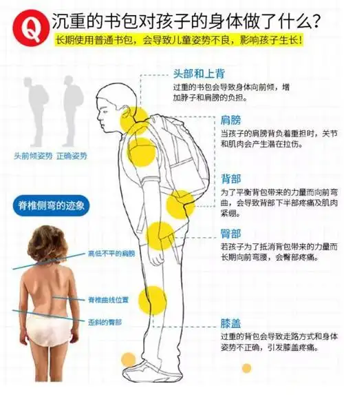 据研究,长期背这么重的书包,很容易对还在发育中的孩子造成弓背,高低