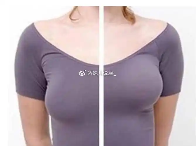 或多或少都曾因为胸部的外形而烦恼过,特别是胸部下垂