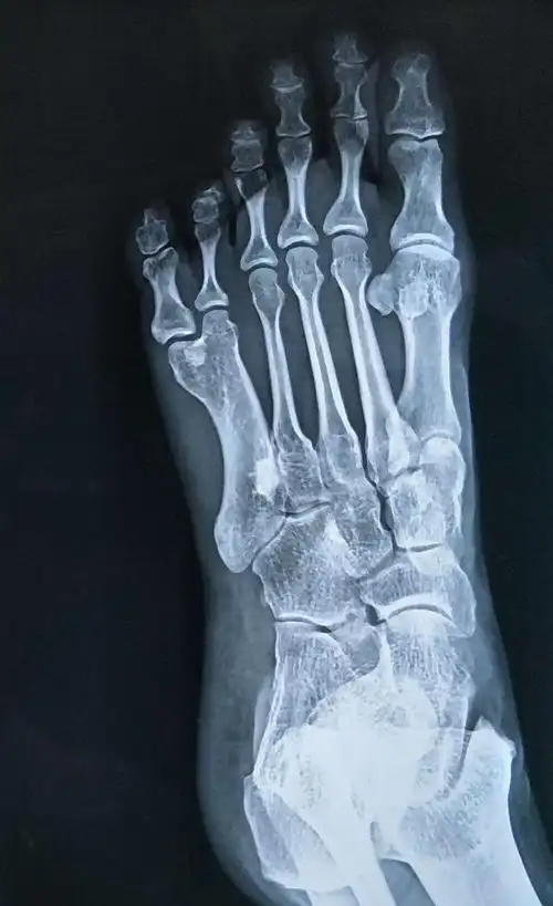 青县康泰医院 骨科