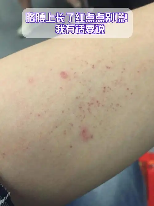 胳膊上长了红点点别慌!我有话要说