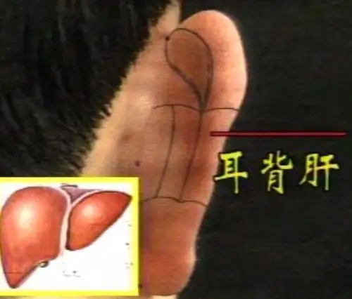 主治胃痛,消化不良,食欲不振.耳背肺,定位在耳背中内部,即耳4区.